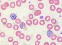 Plasmodium Vivax