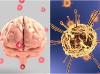 Brain illness in Canada