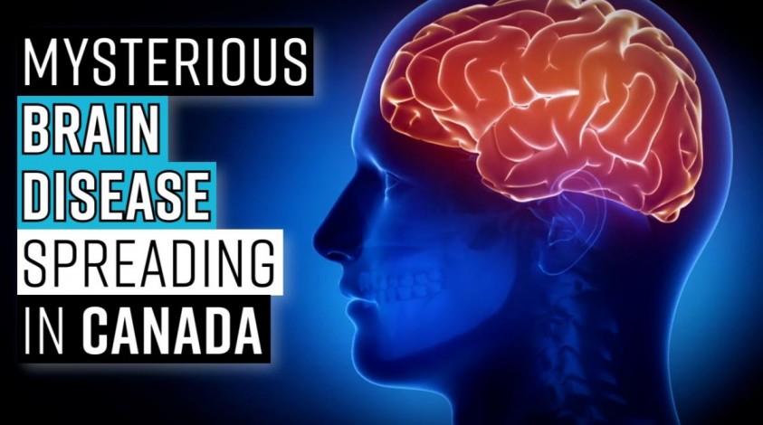 Mysterious Brain Disease Spreading in Canada