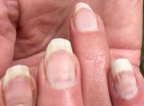 COVID Nails