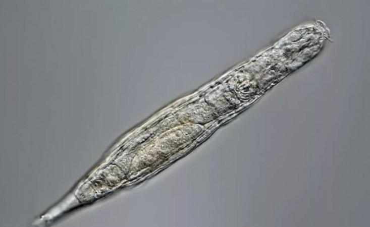 Bdelloid Rotifier Bdelloid rotifer