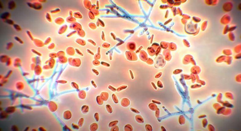 Candida auris causing infection (Representational Picture) Superbug