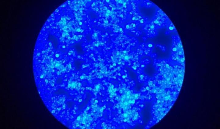 Fluorescence microscopy image illustrating morphology of C. auris. Superbug