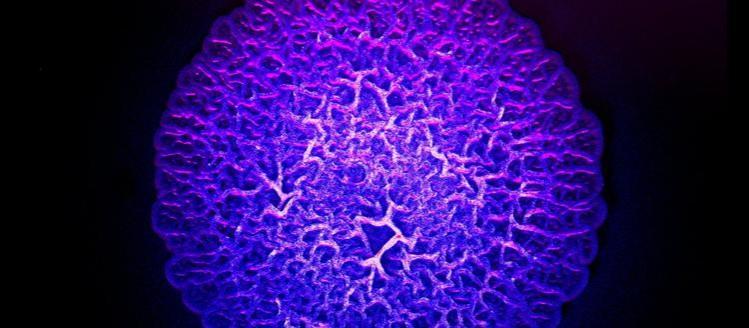 Surface architecture of a Pseudomonas aeruginosa colony grown for three days on semi-solid medium (stereomicroscope, artificial color) Pseudomonas aeruginosa
