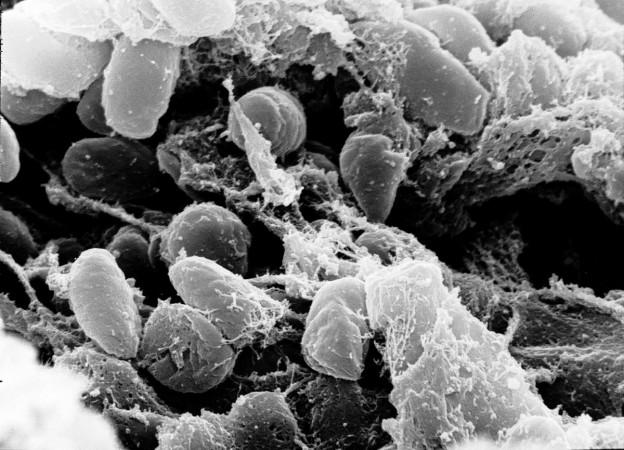 Yersinia pestis (Representational Picture) Yersinia pestis
