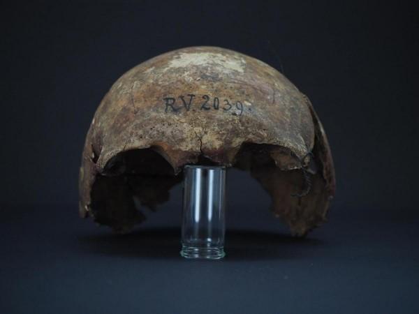This image shows the skull bones of the man buried in Rinnukalns, Latvia, around 5,000 years ago RV 2039
