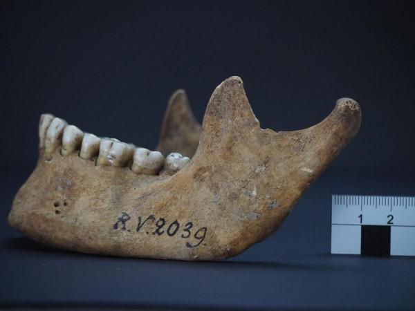 This image shows the jawbone of the man who was buried in Rinnukalns, Latvia, around 5,000 years ago. RV 2039