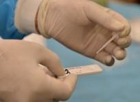 RT-PCR test