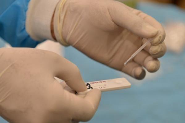 RT-PCR test