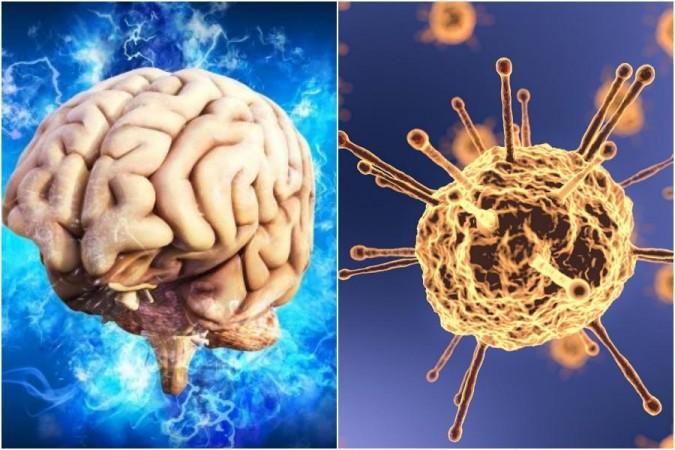 Representational Image brain fog