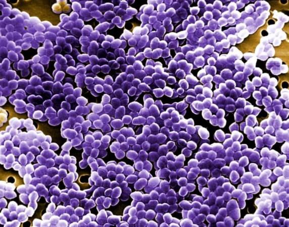 Enterococci bacteria (Representational Picture) Enterococci