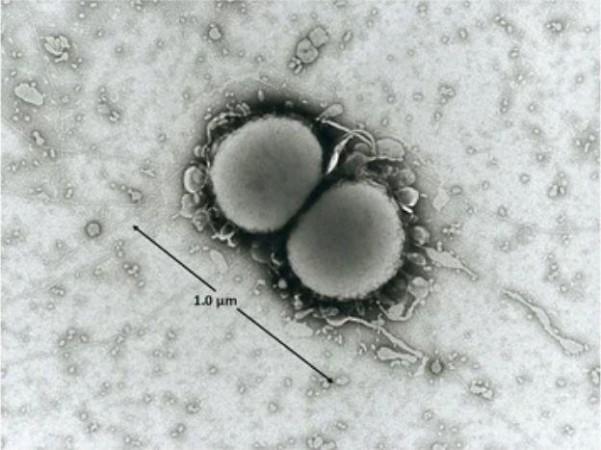 Photomicrograph of N. lactamica (Representational Picture) Neisseria lactamica
