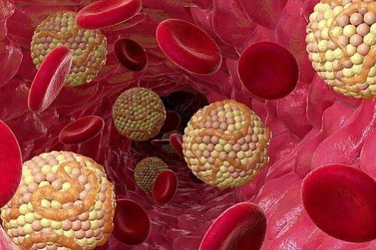 Cholesterol in blood (Representational Picture) Blood Cholesterol