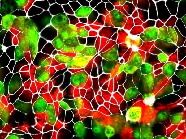 Close up of AEC cultures of Rhesus macaque showing the presence of SARS-CoV-2 infected cells (green) Cells