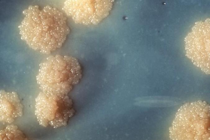 India launches a 100-day TB elimination campaign, aligning with the 'TB-Mukt Bharat' vision Mycobacterium tuberculosis bacteria