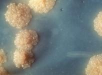Mycobacterium tuberculosis bacteria