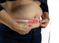 Obesity