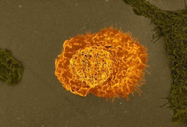 Colorized scanning electron micrograph of a macrophage (Representational Picture) Macrophage