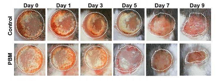 PBM treatments on burn wounds were photographed every other day for up to 9 days and compared to untreated controls Mice burn