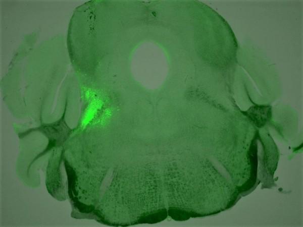 In this image of a mouse brain cross-section, a cluster of neurons that play a critical role in regulating breathing during an opioid overdose is highlighted in bright green. Neuron