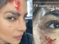 Priyanka Chopra injured
