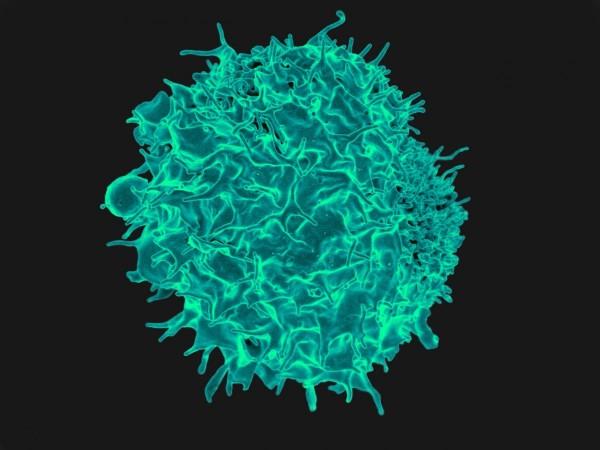 Colorized scanning electron micrograph of a T lymphocyte (Representational Picture) T Cell