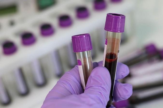 Blood samples (Representational Picture) Blood sample
