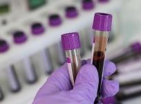 Blood sample