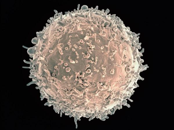 Colorized scanning electron micrograph of a B cell (Representational Picture) B Cell