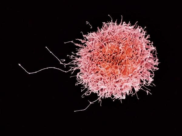 Colorized scanning electron micrograph of a natural killer cell (Representational Picture) NK cell