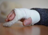 Fracture