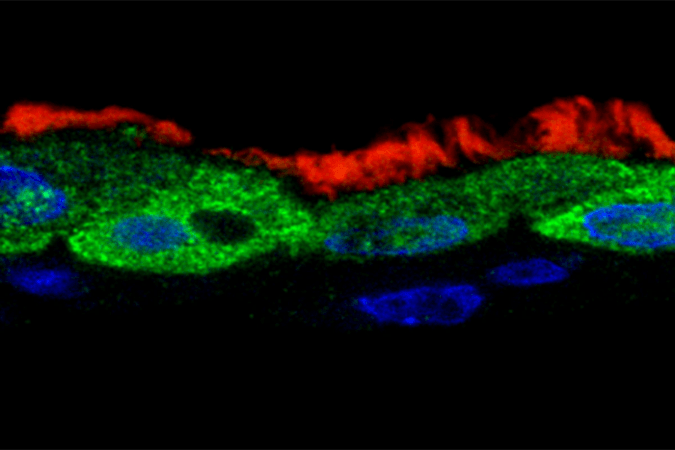 The viral protein NS1 (green) is found inside the nuclei (blue) of ciliated human respiratory tract cells (cilia shown in red) that have been infected with respiratory syncytial virus (RSV) RSV