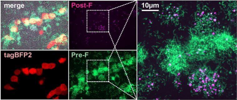 Pre-F and post-F containing RSV particles occur naturally in cell culture RSV