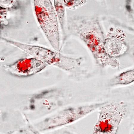 Gold nanoparticle aggregates (red) are observed inside triple negative breast cancer cells after an enzyme-activated assembly and internalization process. Cancer cells