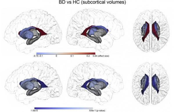 Subcortical volume findings. Effect sizes and significance of group differences (p-value; bottom) between BD patients and HC. The Figure displays the overall pattern of uncorrected raw results. See Figure 3 for findings after multiple comparisons correction. Positive effect sizes (warm red colors) represent BD > HC patterns (HC declines faster/increases less). Negative effect sizes (cold blue colors) represent BD < HC patterns (BD declines faster). Brain