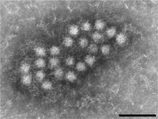 Torquetenovirus (Representational Picture) Torquetenovirus (TTV)