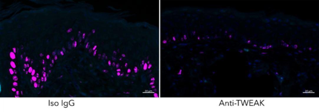 The Croft Lab captured how the proliferation of skin cells, as seen in psoriasis (indicated with purple staining), decreased when TWEAK activity was blocked Skin