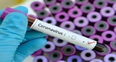 Covid test