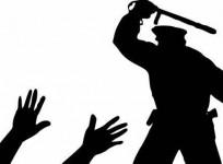 Journo in custody, alleges torture by cops