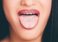 mouth