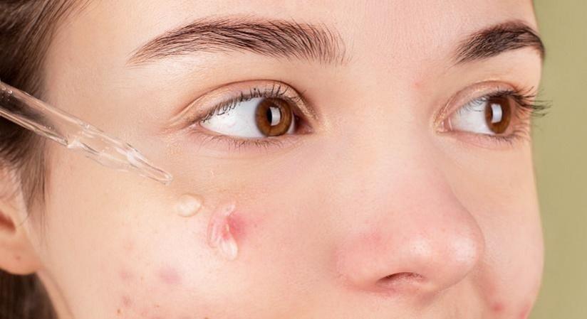 The importance of cleaning clogged pores The importance of cleaning clogged pores