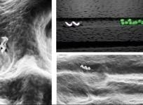 Tiny bots that can help clean teeth - new study by IISc.