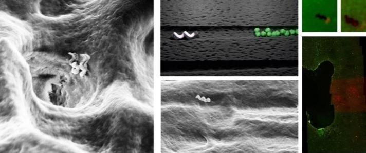 Tiny bots that can help clean teeth - new study by IISc. Tiny bots that can help clean teeth - new study by IISc.