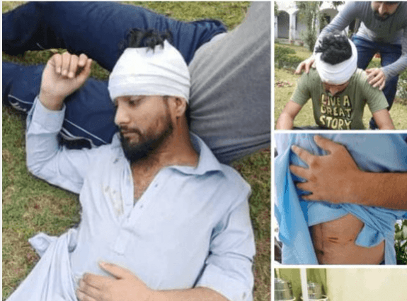 Injured Kashmiri students
