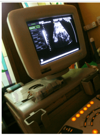 Ultrasound Reuters Ultrasound