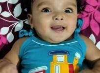 Telangana baby with rare genetic disease administered Rs 16 crore drug