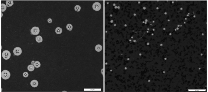 The infectious fungus Cryptococcus neoformans rapidly enlarges and shrinks in size to withstand different microenvironments in the body Cryptococcus neoformans