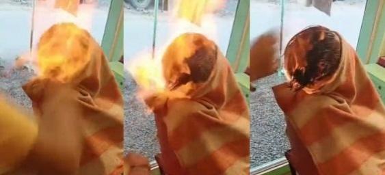 An eighteen year old suffered burns injuries on his face and chest while going for fire hair cut in Vapi town of Valsad district (South Gujarat) An eighteen year old suffered burns injuries on his face and chest while going for fire hair cut in Vapi town of Valsad district (South Gujarat)