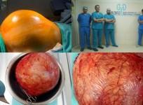 Doctors at Hyderabad hospital remove football-sized kidney tumour.