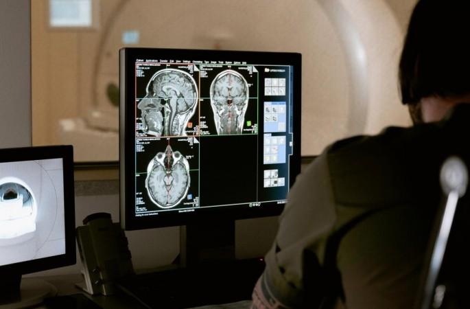 Woman diagnosed with brain tumour after hallucinations tell her to have CT scan Woman diagnosed with brain tumour after hallucinations tell her to have CT scan